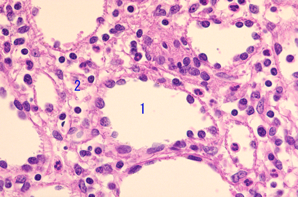 splenicsinus04.png