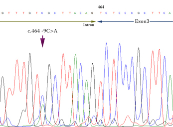 InS-IWT-NKX2-intronic-mutation02.jpg