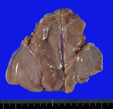 Thymusmacro.jpg