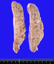 thymuscut.jpg