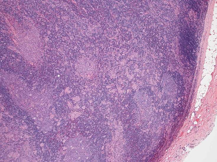 toxoLN01.jpg