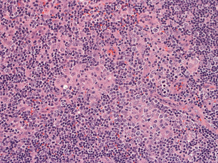 toxoLN02.jpg