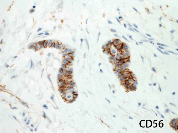 CD56b.jpg
