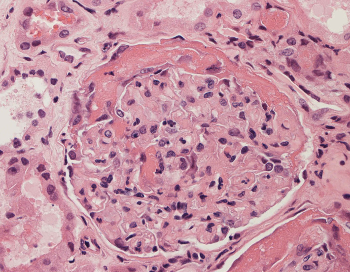 kidney02.jpg