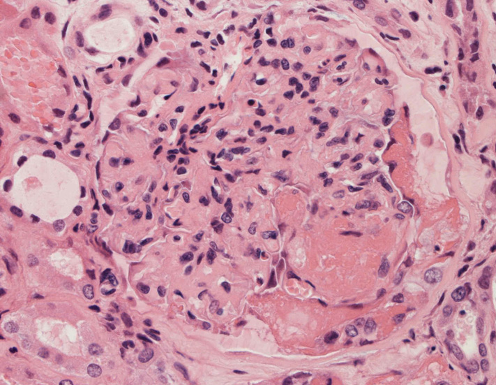 kidney03.jpg