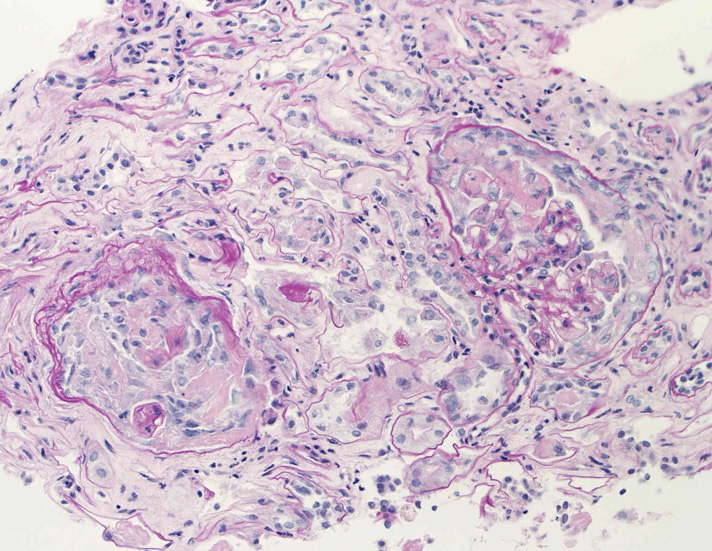 kidney04pas.jpg