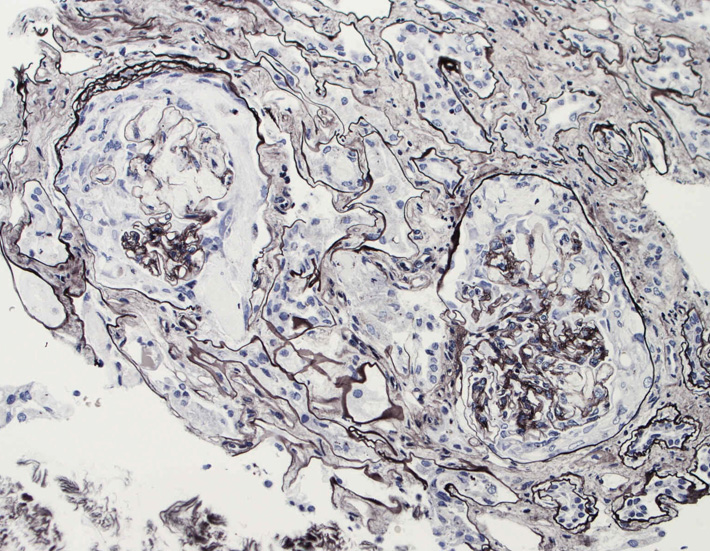 kidney05.jpg