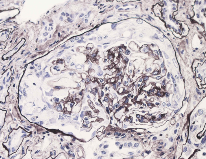 kidney06.jpg