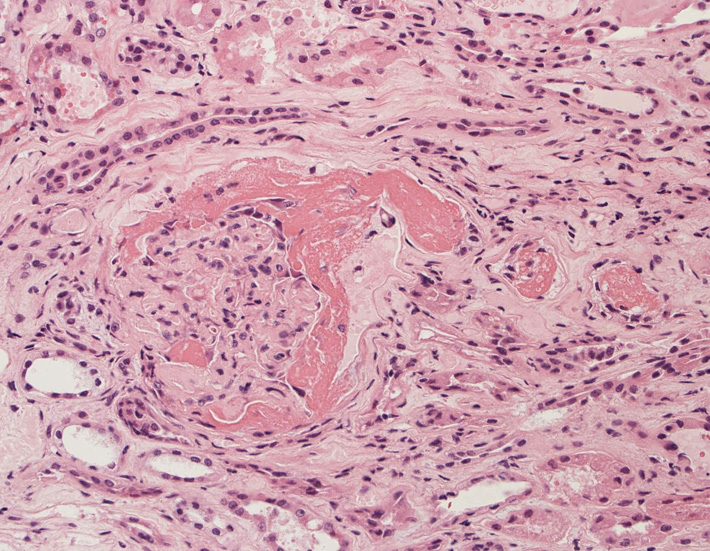kidney07.jpg