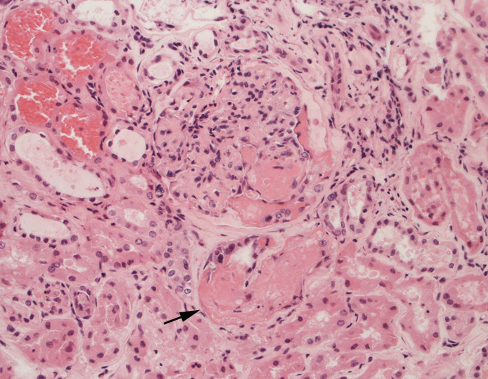 kidney08.jpg