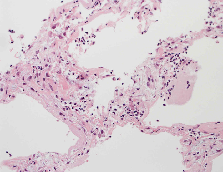 lung02.jpg
