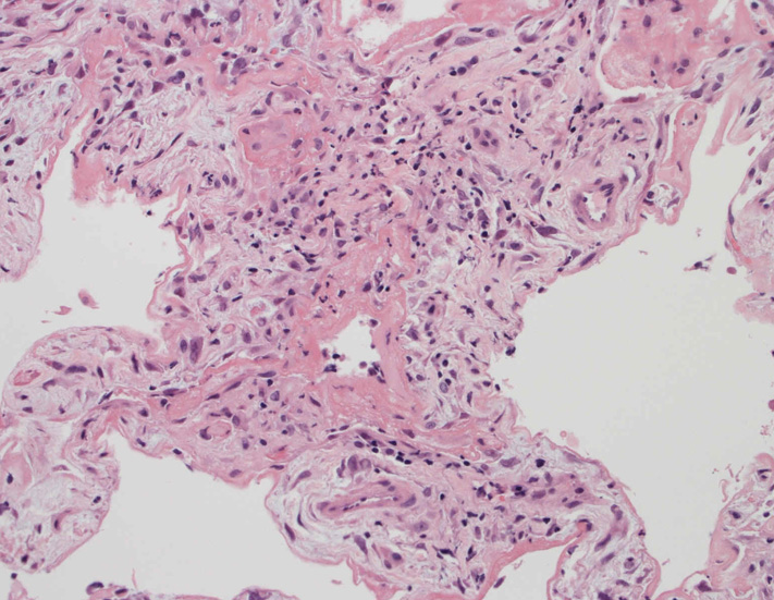 lung04.jpg