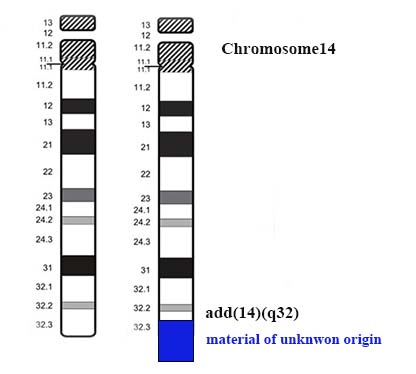 chr14-ISCN-zuOK.jpg
