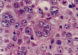 Bizzarre cell01.jpg