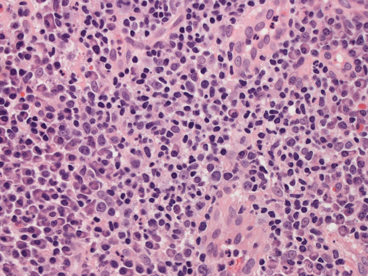 lymphocytes01.jpg
