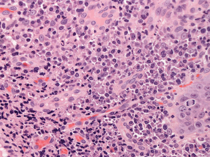 plasmacells02.jpg