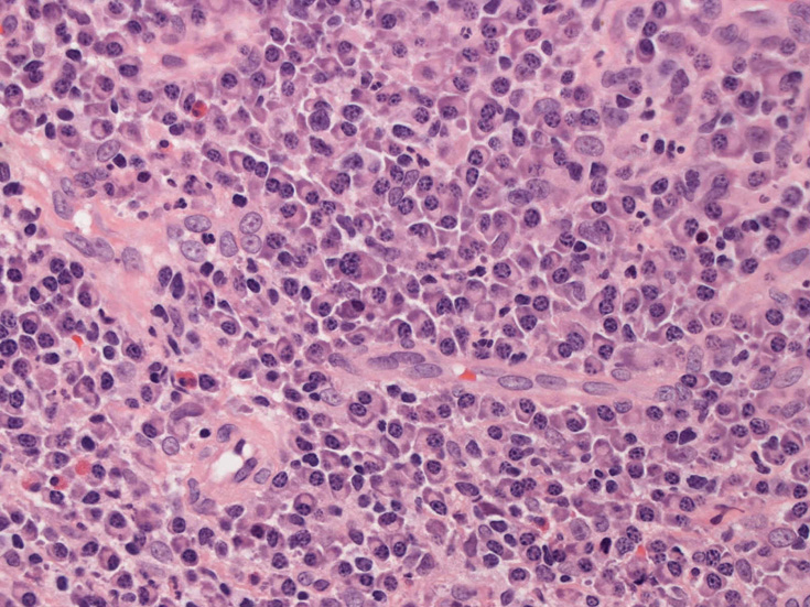 plasmacells03.jpg