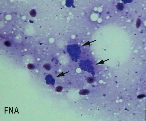 toxocytology.jpg