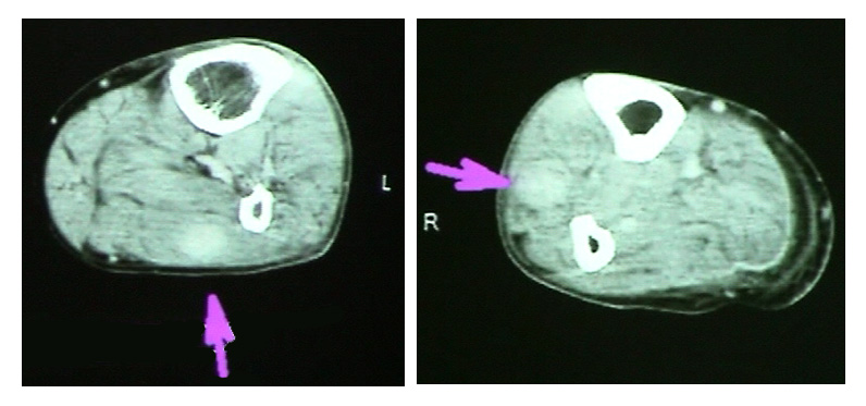 CTtoxo01.jpg