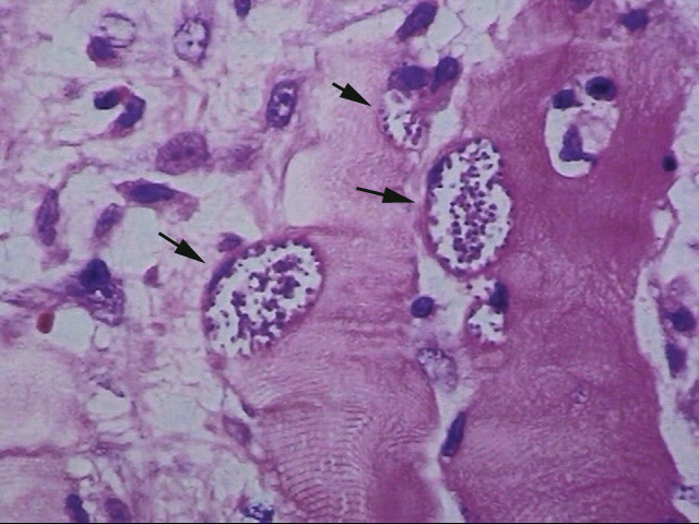 toxo04.jpg