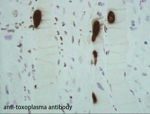 toxoimmu01.jpg