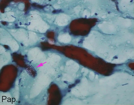toxopap01.jpg